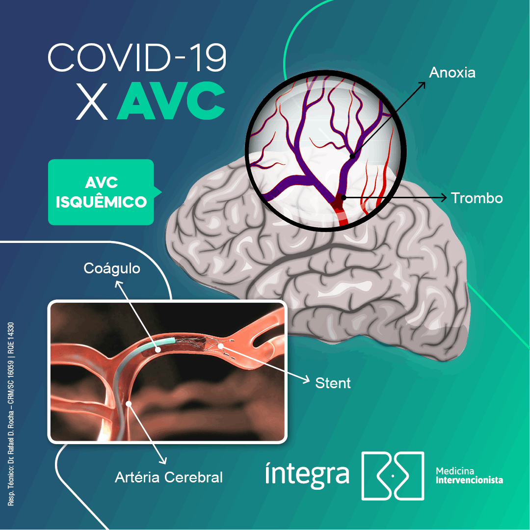 COVID-19 x AVC