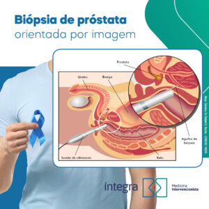 biopsia de prostata