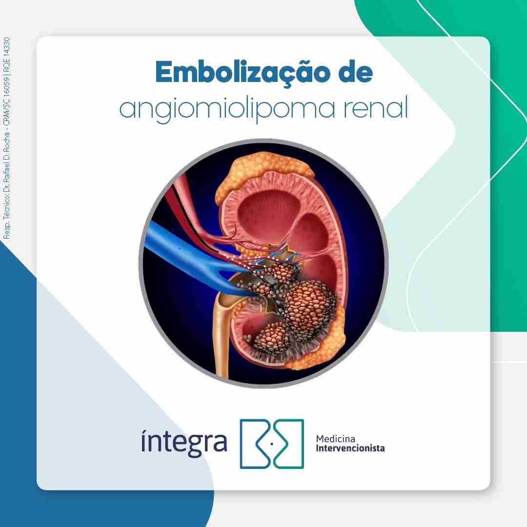 figura ilustrando um angiomiolipoma