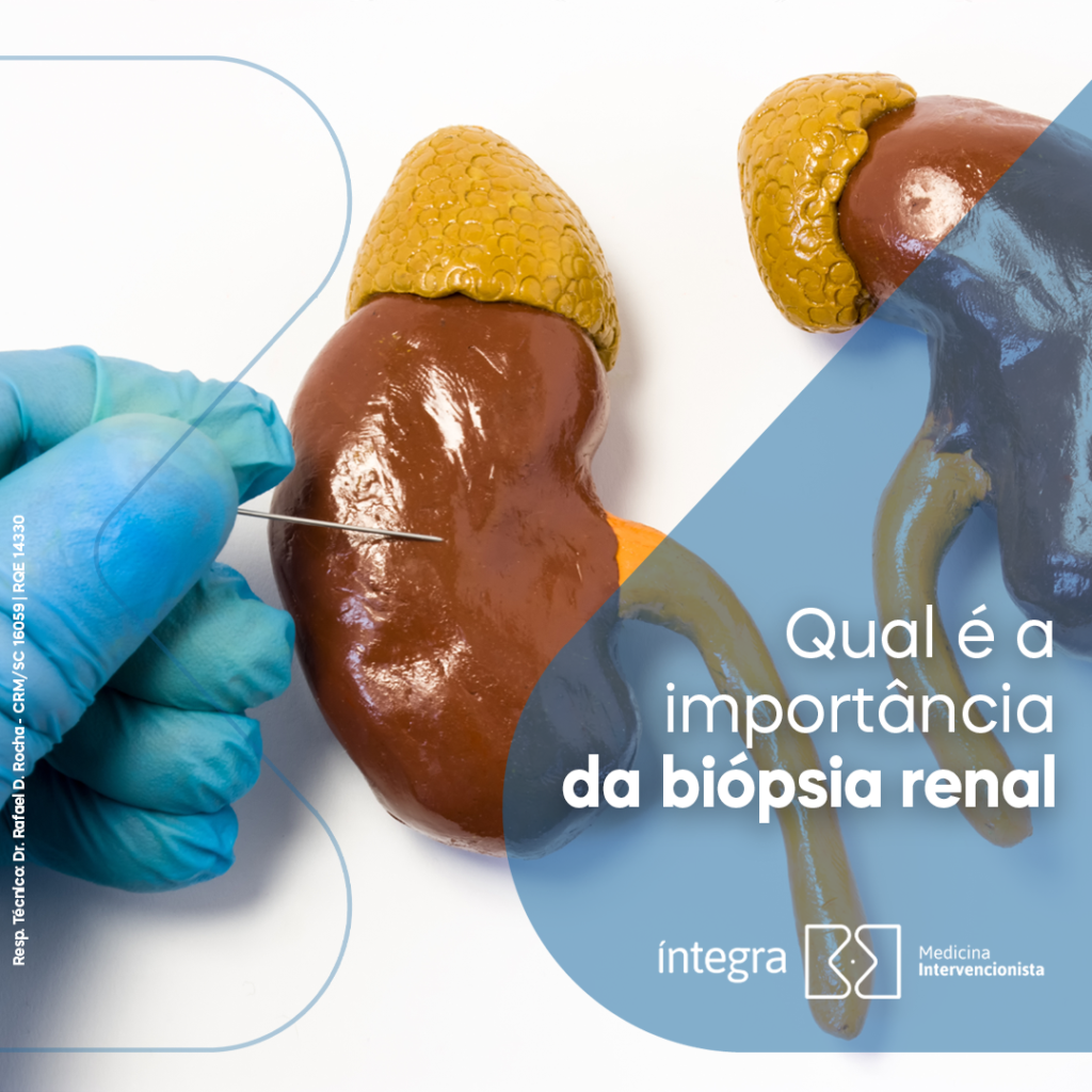 biopsia renal