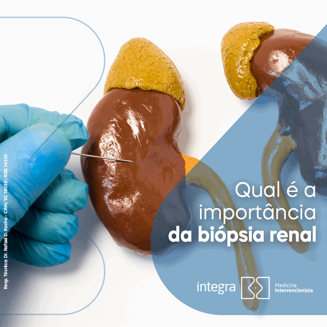 Qual é a importância da biópsia renal?