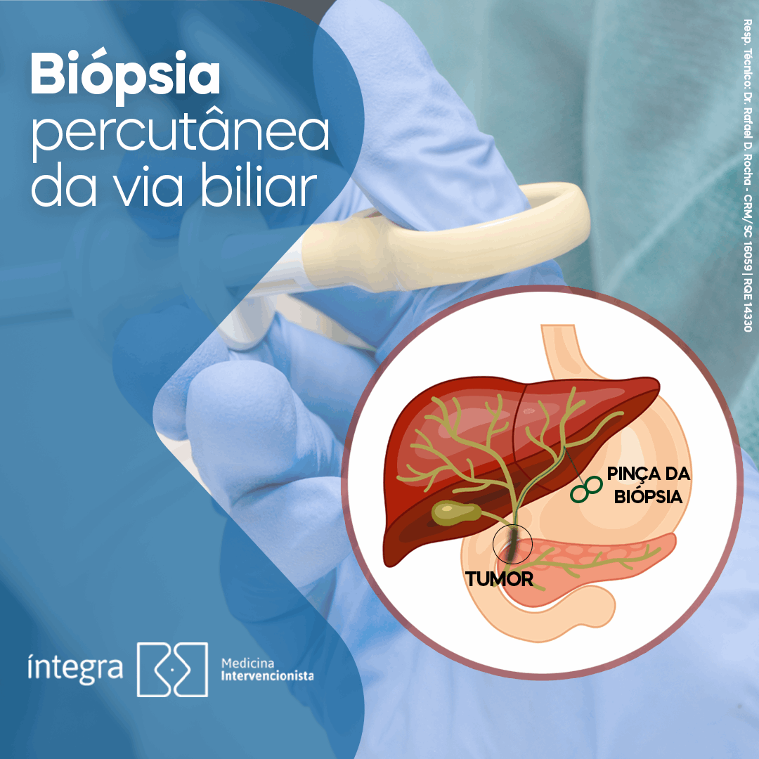 O que é a biópsia percutânea da via biliar?