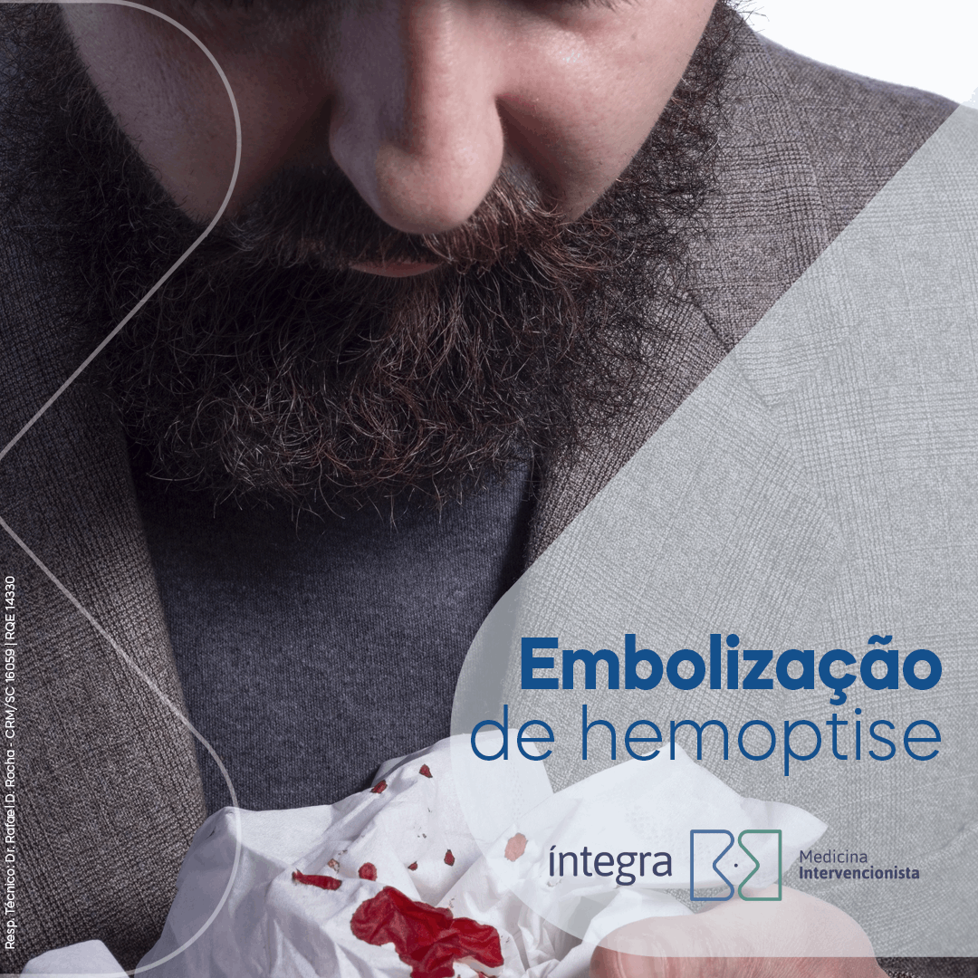 Embolização de hemoptise, a tosse com sangue