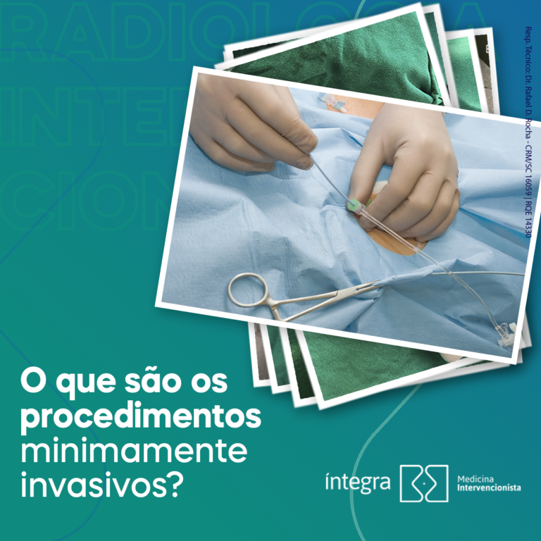 O que são procedimentos minimamente invasivos? Dica Médica O que são procedimentos minimamente invasivos? Dica Médica