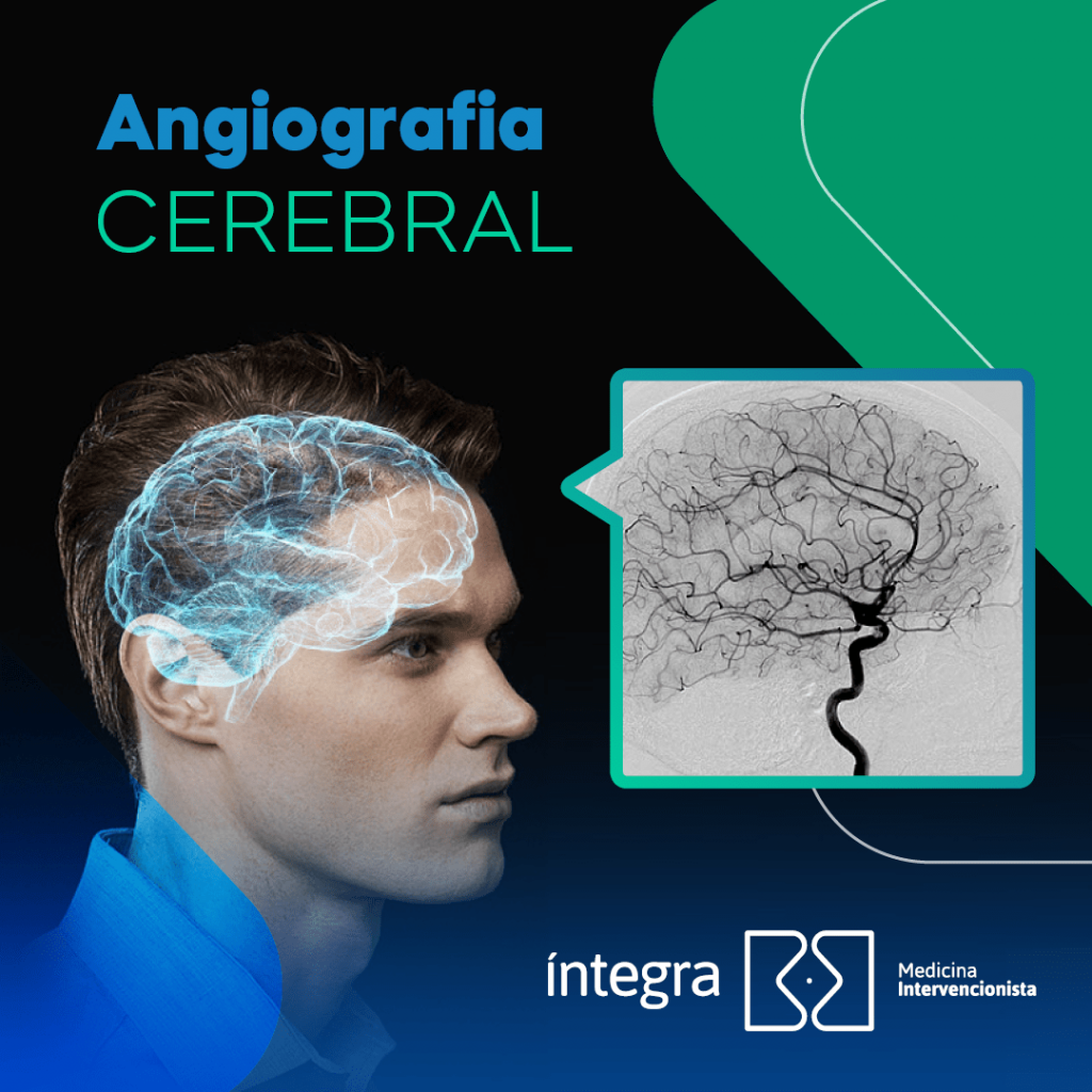 arteriografia cerebral