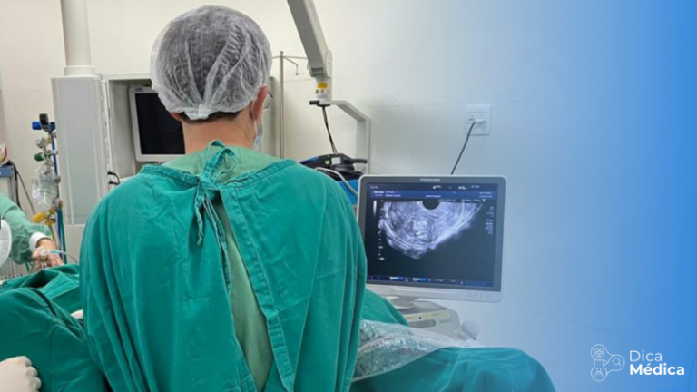 Dr. Maurício Amoedo durante procedimento de ablação de miomas uterinos