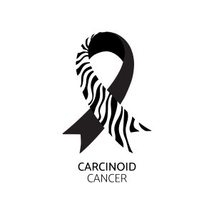 carcinoide
