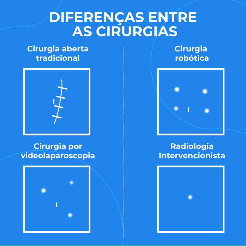 diferenças entre os tipos de cirurgias