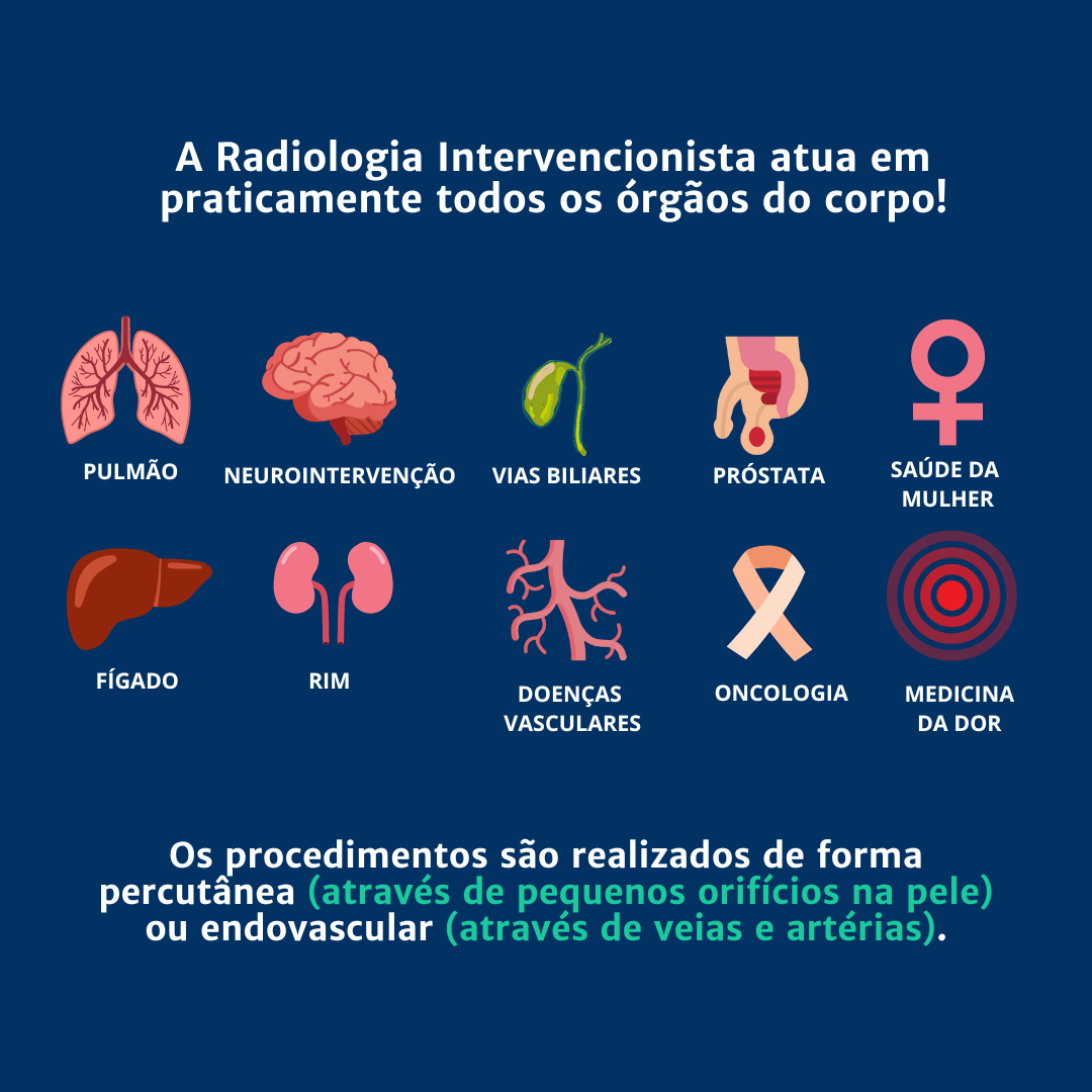 órgãos que a radiologia intervencionista pode atuar