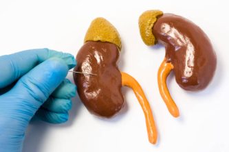 Kidney or renal biopsy or puncture procedure concept photo. Doctor holding puncture needle  and punctures kidney anatomical shape on white table. Renal biopsy operation to obtain tissue for analysis